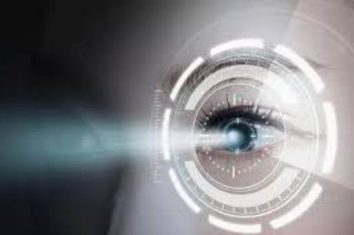 近视眼手术展示图 近视眼手术展示图