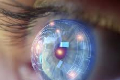 单眼近视手术 单眼近视手术