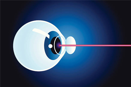 了解完近视手术区别优缺点后,就知道选择哪种手术方式!