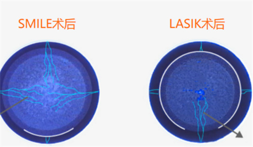 全飞秒半飞秒对比图