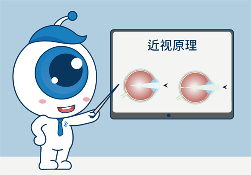 近视原理图示意图 近视原理图示意图