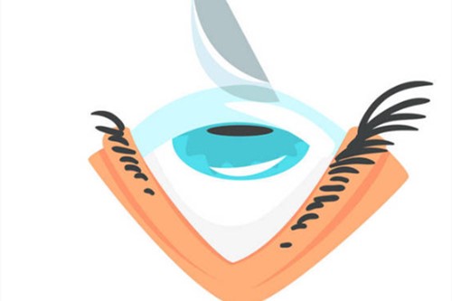 国内近视眼手术价格表已更新,北上广深川渝近视收费均在内!