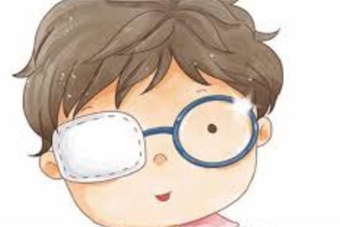 斜视眼睛矫正手术多少钱贵不贵?只有动手术这一种方法么!