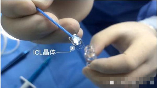 晶体植入图示