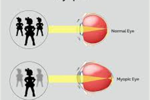 瞳距示意图 瞳距示意图