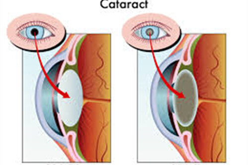 晶体示意图 晶体示意图