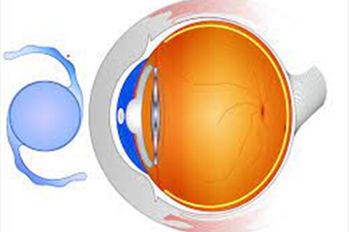 晶球示意图 晶球示意图