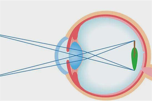 近视成像示意图