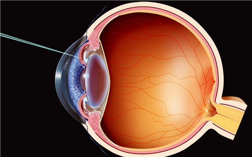 眼球侧面结构图 眼球侧面结构图