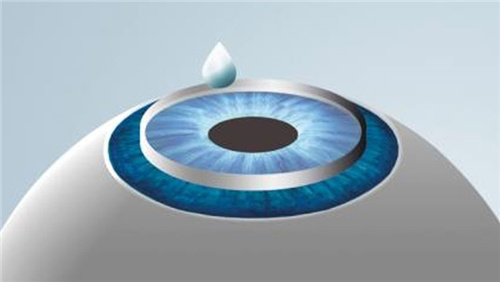 近视手术做瓣膜