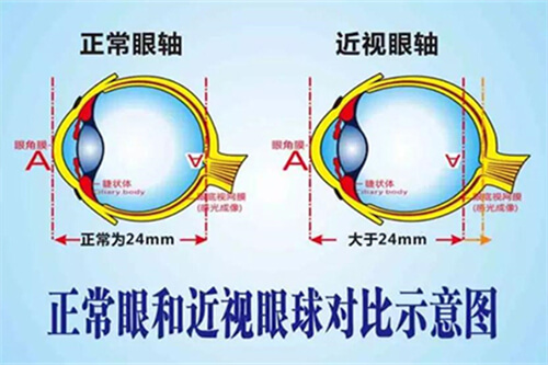 正常眼和仅是眼球对比示意图