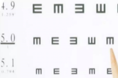 视力检测示意图