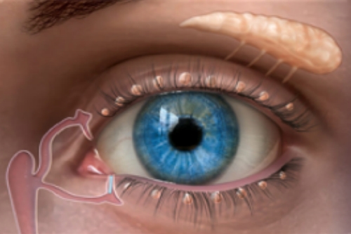 泪点栓子植入术动画示意图 泪点栓子植入术动画示意图