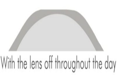 白天摘掉塑形镜的角膜形态 白天摘掉塑形镜的角膜形态