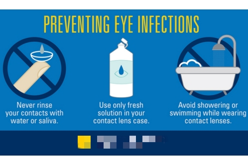 配戴隐形眼镜注意事项示意图