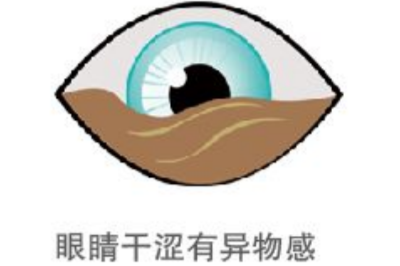 干眼症干涩有异物感示意图 干眼症干涩有异物感示意图
