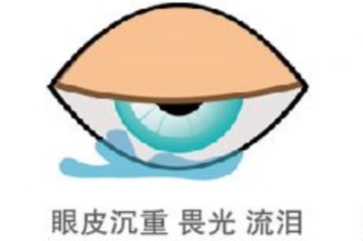 干眼症症状示意图 干眼症症状示意图