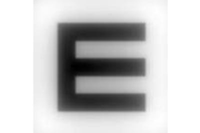 干眼症造成视物模糊 干眼症造成视物模糊