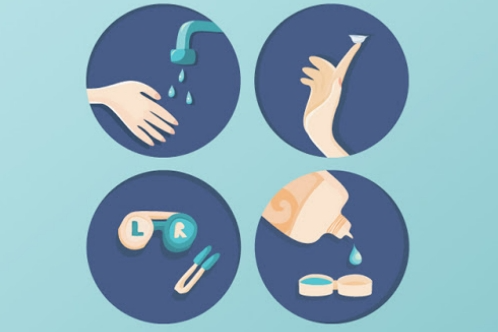 角膜塑形镜的配戴使用示意图 角膜塑形镜的配戴使用示意图