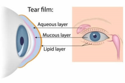 干眼手术动画示意图 干眼手术动画示意图