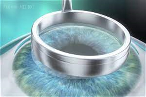 Smart全激光示意图