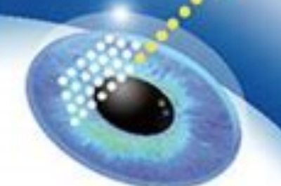 全飞秒手术示意图