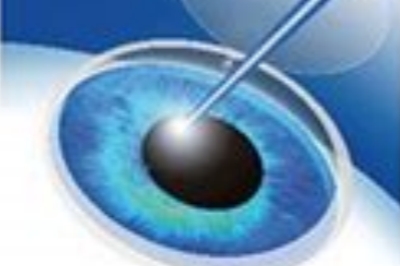 揭秘全飞秒手术的危害及后遗症以及术后注意事项不容错过哦！