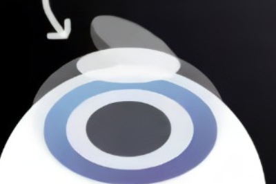 半飞秒手术示意图