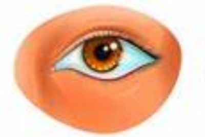 泪囊炎发展历程