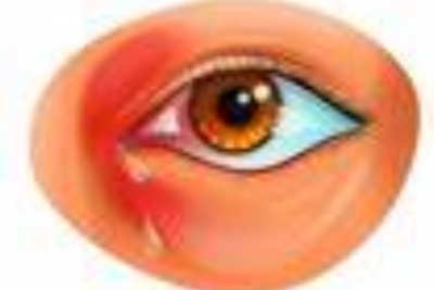 泪囊炎发展历程