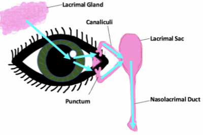 泪囊炎手术示意图
