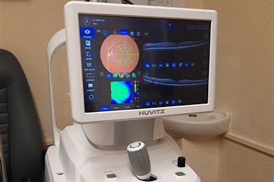 眼部OCT检查仪器