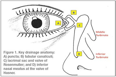 泪道探通手术 泪道探通手术