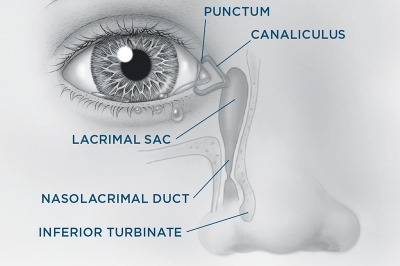 泪道探通手术 泪道探通手术