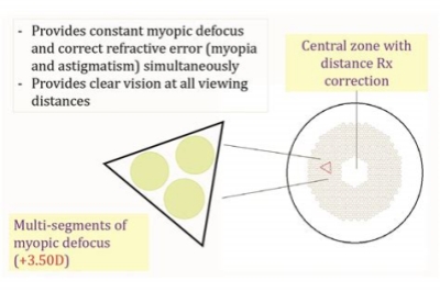 离焦镜片原理 离焦镜片原理