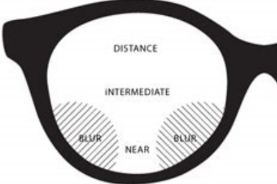 离焦镜片 离焦镜片