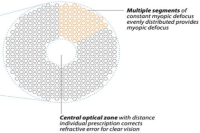 离焦镜片原理 离焦镜片原理