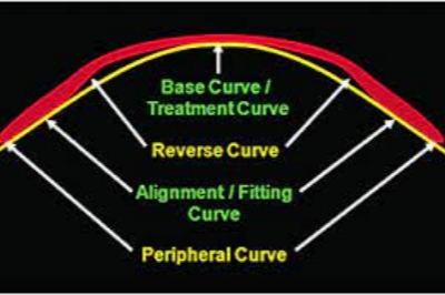 角膜塑形镜各弧区示意图