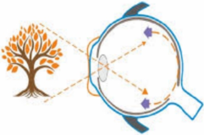 美国CRT角膜塑形镜价格表：一文告诉你怎么样，值这个价吗？