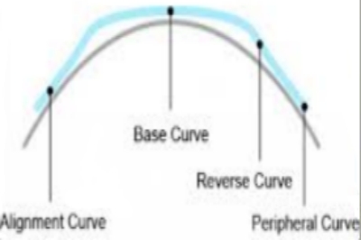 角膜塑形镜各弧段示意图
