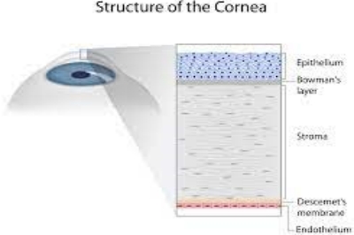 smart手术角膜示意图