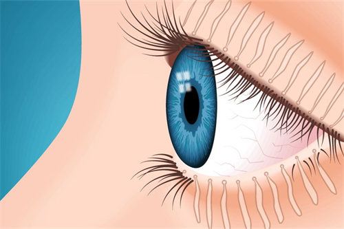 近视手术会加重干眼症状吗？可能会，但这并不意味着所有接受近视手术的人都会出现这种情况！