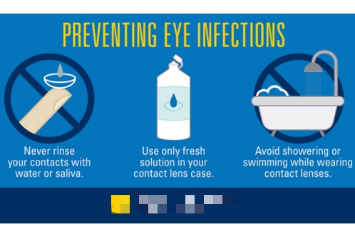 隐形眼镜注意事项示意图 隐形眼镜注意事项示意图