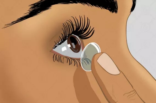 隐形眼镜佩戴示意图 隐形眼镜佩戴示意图