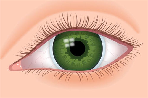 隐形眼镜在眼睛内示意图 隐形眼镜在眼睛内示意图