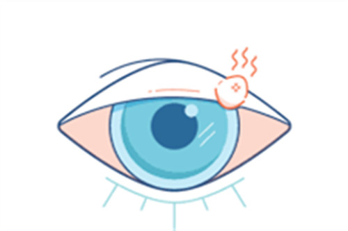 消除麦粒肿不再是难题！这十个问题解答你的疑惑！