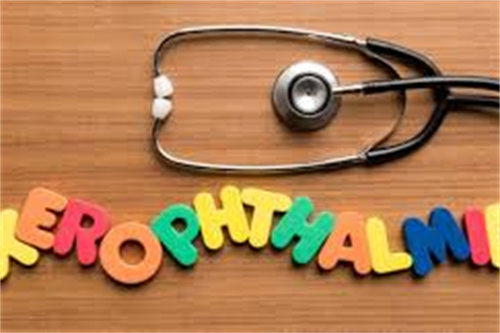 干眼症文字示意图 干眼症文字示意图