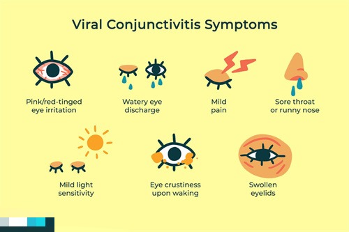 结膜炎症状示意图