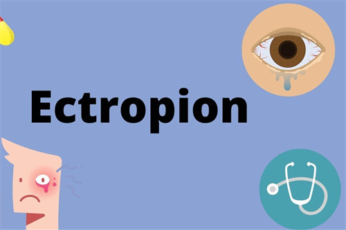 科普：眼睑下翻的原因都有哪些呢？从根源上解决问题