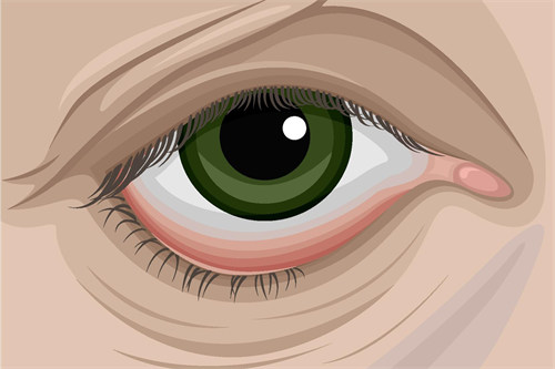 眼睑下翻示意图